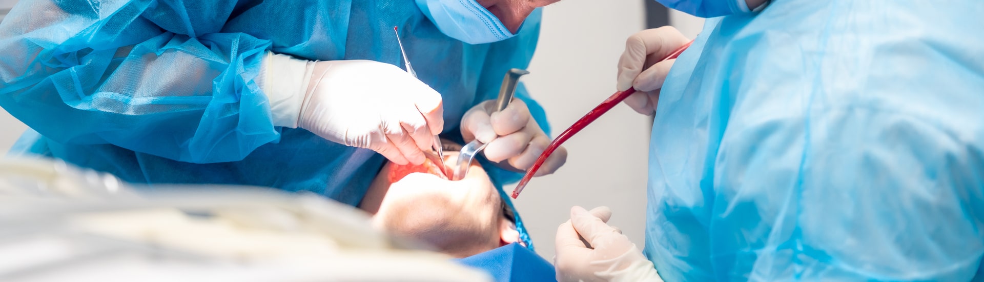 Diş Kisti Ameliyatı